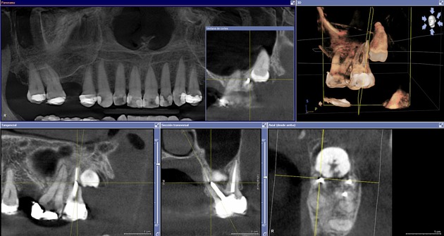 image cone beam dentaire