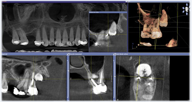 image description cone beam dentaire CBCT