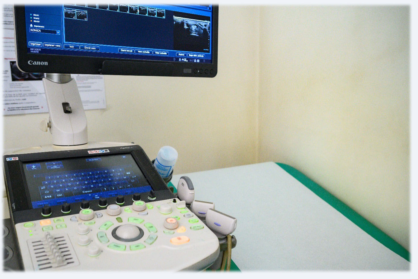 image description echographie abdominale