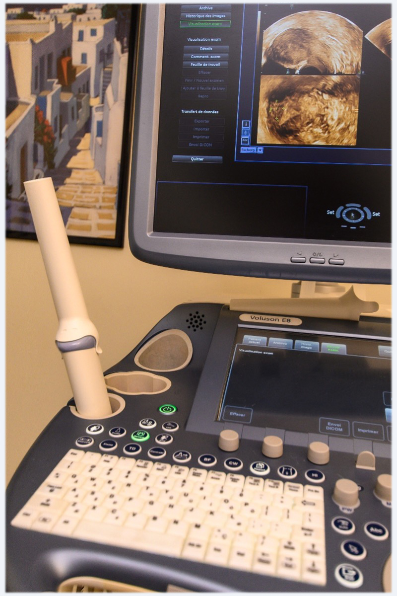 image description echographie grossesse