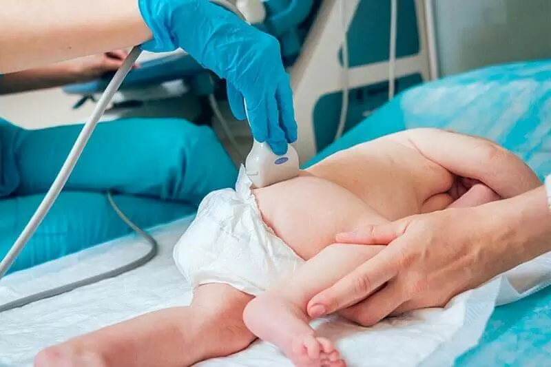 image echographie hanche