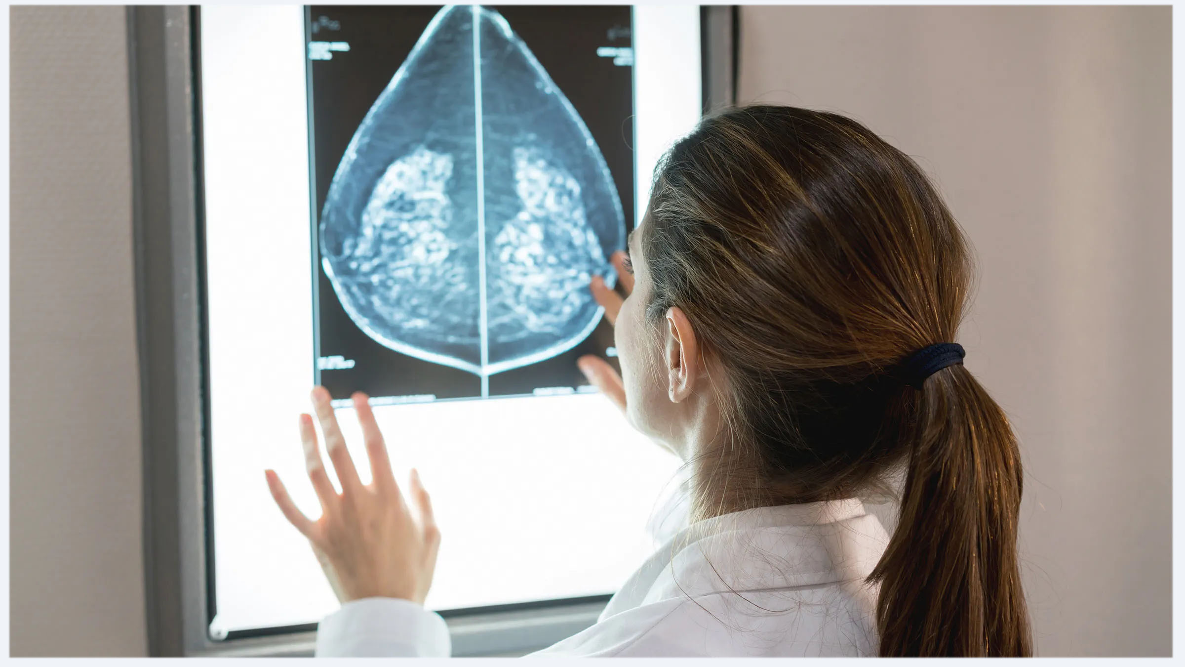 image description echographie mammaire