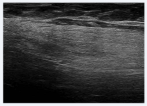 image description echographie musculo tendineuse