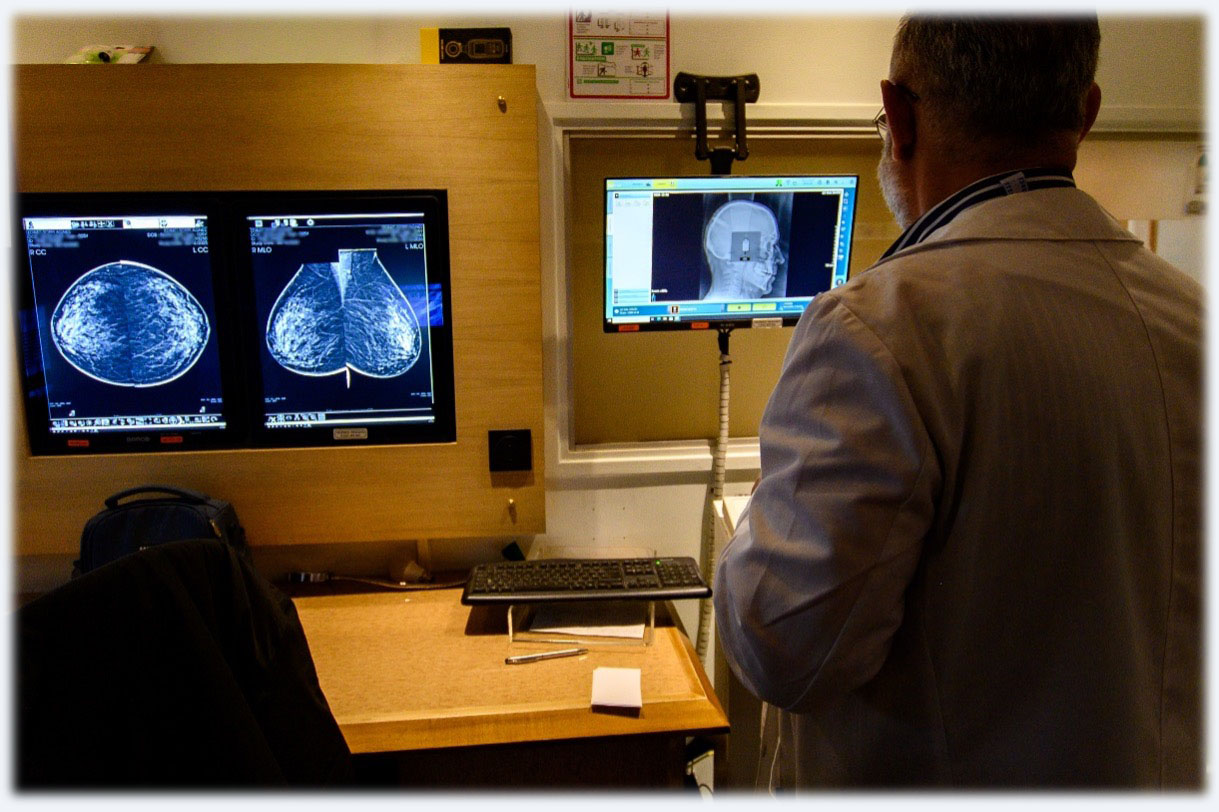 image description mammographie