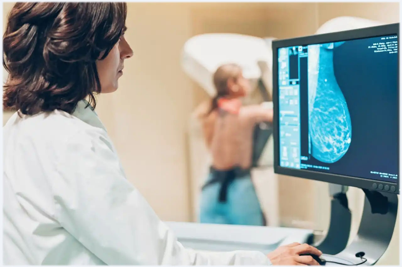image mammographie