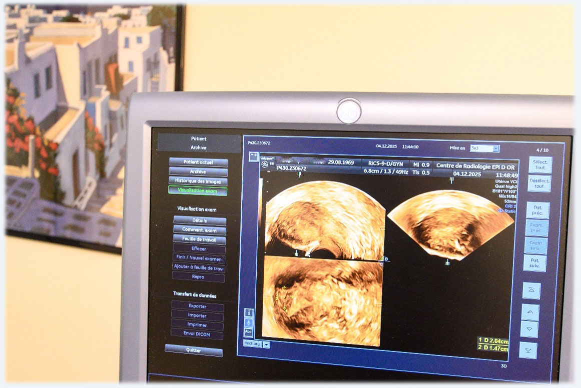 image description monitorage de l'ovulation