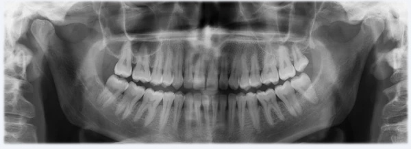 image description radio panoramique dentaire
