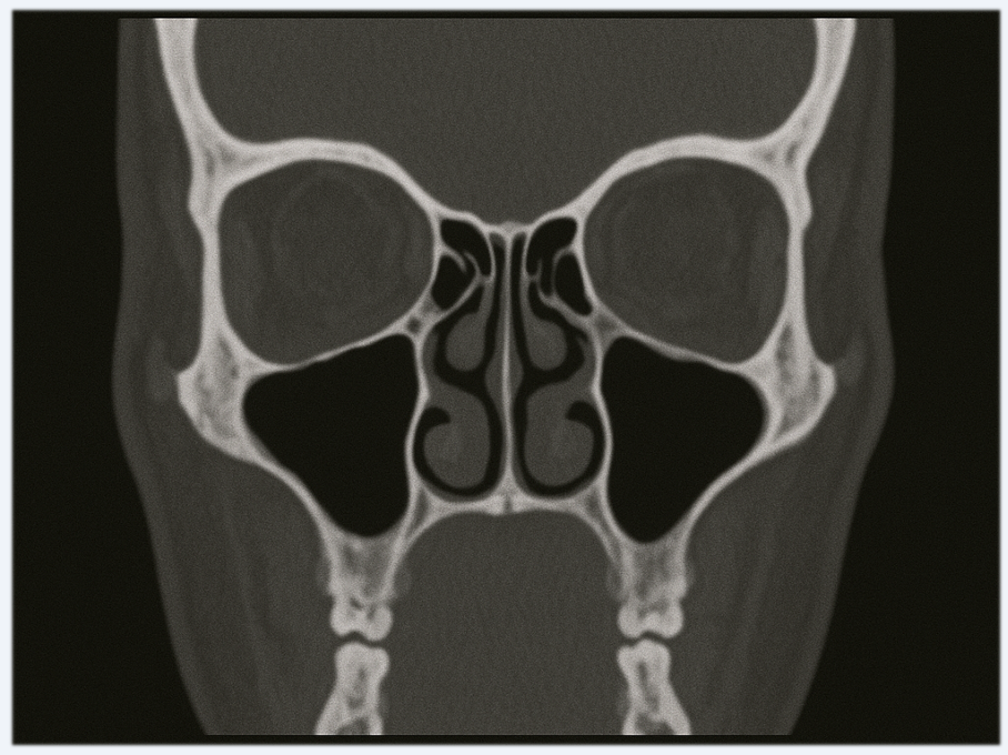 image description scanner sinus